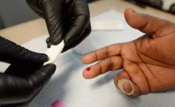 GOOD NEWS!!! Nigerian Scientists Find Cure For HIV/AIDS